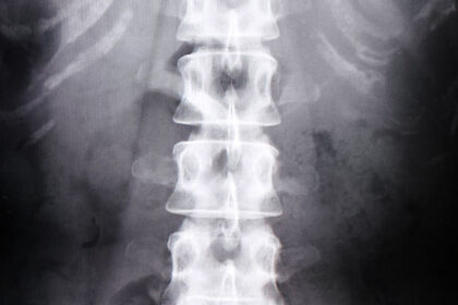 レントゲン画像
